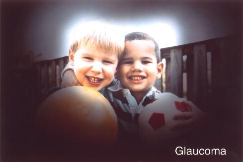 vision-with-glaucoma